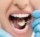 Way paved to diagnose oral cancer metastasis better