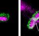 Big Breakthrough in the Battle Against Antibiotic Resistance