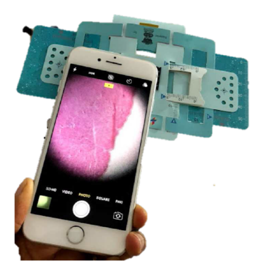 Foldscope A Better Alternative to Clinical Microscope Delhi Post