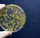 Bacterial Study Gives Fresh Insights on Diabetes and Fibrosis