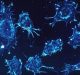 Treatment of Tonsil Cancer: A New Way Forward