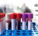 Molecular Sensor on Serotonin Receptor to Detect Cholesterol
